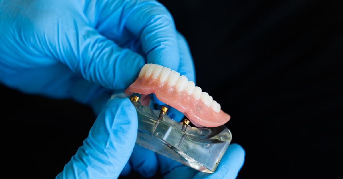 clinician in blue gloves showing the denture creation process for lower teeth dentures
